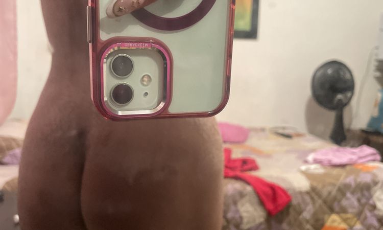 Glúteo se ve igual después de lipotransfer - 82182