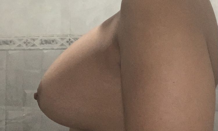 Prótesis del pecho izquierdo no se han terminado de colocar - 82323