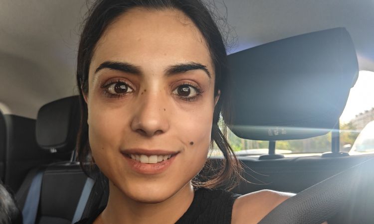 Problemas tras la septorinoplastia - 82494