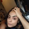 Problemas tras la septorinoplastia