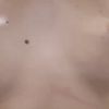 No me gusta mi pecho