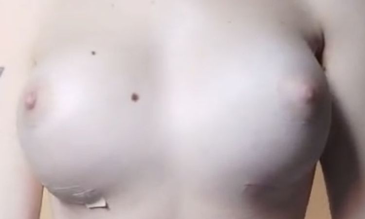 No me gusta mi pecho - 82856