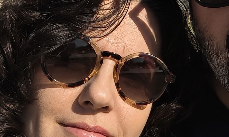 Rinoplastia quería corregir desviación y está igual - 83395