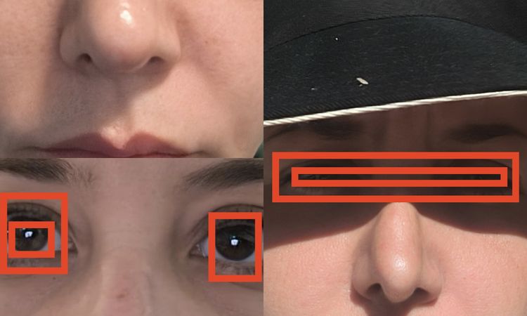 Rinoplastia quería corregir desviación y está igual - 83397