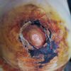Posible necrosis de areola tras mastopexia