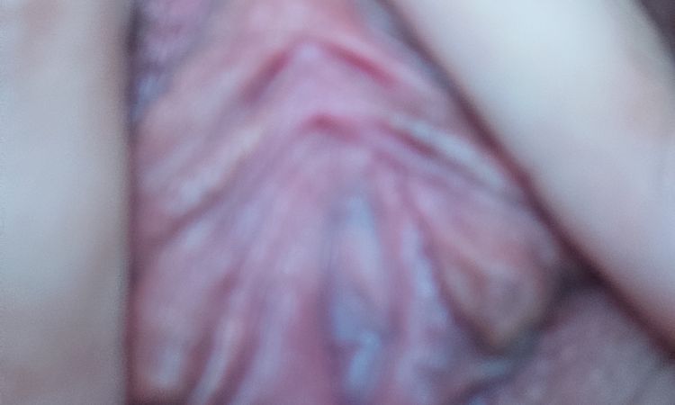 quiero saber si mi himen está inteacto aun o ya no puedo sacarme el pañuelo. - 84499