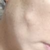 Hilos tensores vprolift threaths