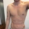 No veo resultados 5 semanas de mi marcacion abdominal con vaser renuvion