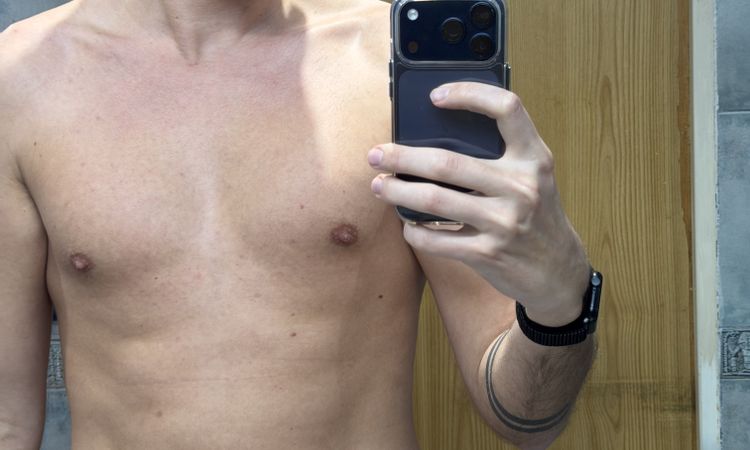 No veo resultados 5 semanas de mi marcacion abdominal con vaser renuvion - 84851