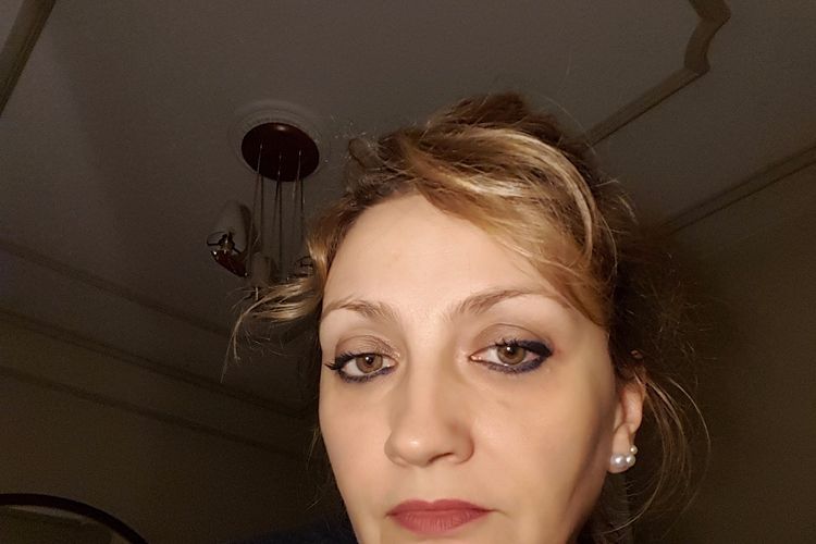 ¿Relleno de pomulos permanente?