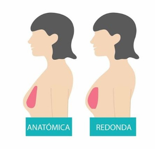 Forma de los implantes mamarios