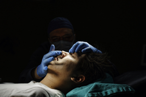 Rinoplastia secundaria