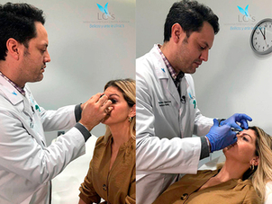 médico de rinomodelación