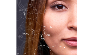 s resultados son más evidentes en los 2-3 meses posteriores por la estimulación del colágeno