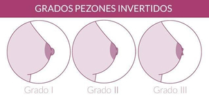 Grados de pezones invertidos