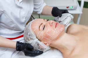 rejuvenecimiento facial con láser