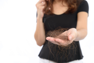 causas de la alopecia