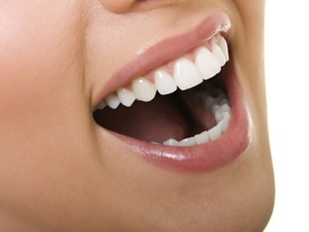 ventajas ortodoncia