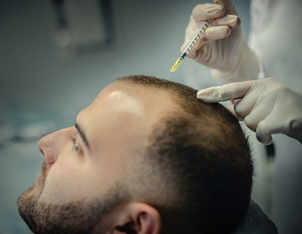 ¿Qué es la Mesoterapia Capilar?