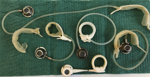 Procedimiento de banda gástrica ajustable