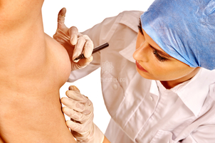 Reconstrucción del pezón y la areola