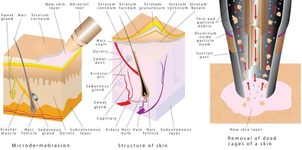 microdermoabrasión beneficios