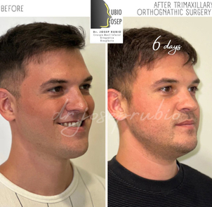 preparación cirugía maxilofacial