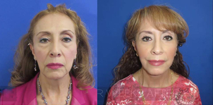 ¿Cómo son los resultados?