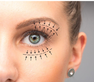 blefaroplastia láser