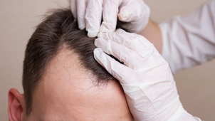 Preparación mesoterapia capilar