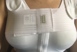 Efectos secundarios aumento de senos