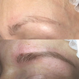 resultados microblading