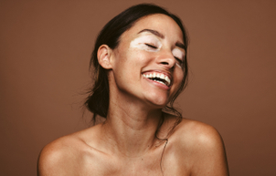 El vitíligo es un trastorno autoinmunitario crónico y de larga duración que se manifiesta a través de manchas blancas en la piel