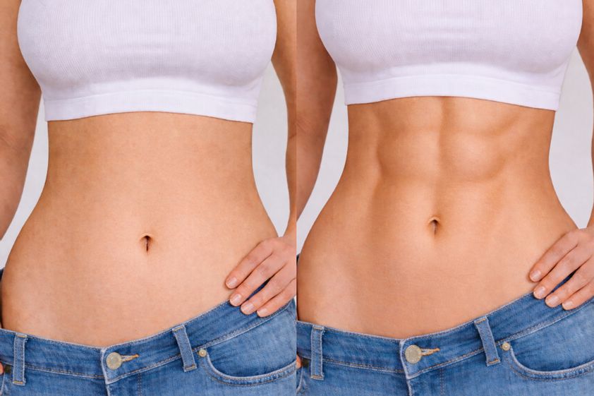 Marcación abdominal