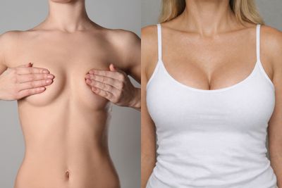 Antes y después de Mia Femtech™