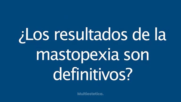 Mastopexia - Clinimagen