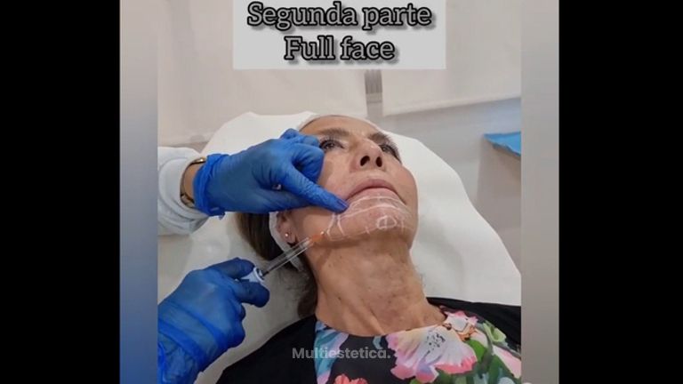 Full face - Dra. Any Ramírez