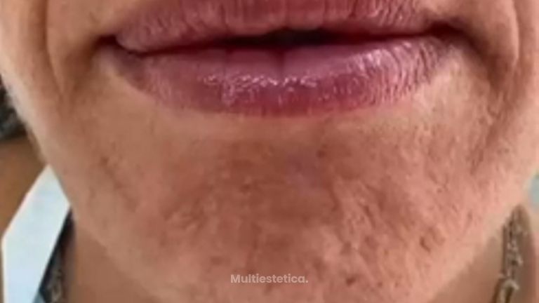 La homeostasis cutánea es clave para una piel saludable y radiante.