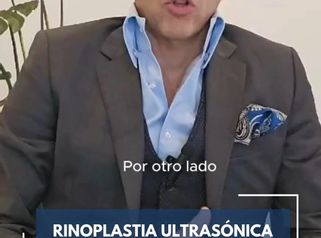 Rinoplastia ultrasonica ¿Qué es?