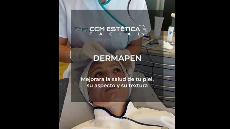Rejuvenecimiento facial - CCM Estética