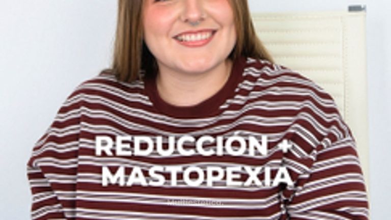 Reducción mamaria - Clínica Opción Médica