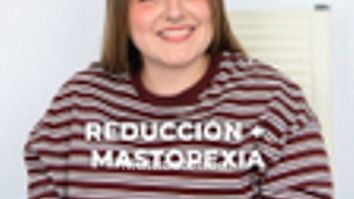 Reducción mamaria - Clínica Opción Médica