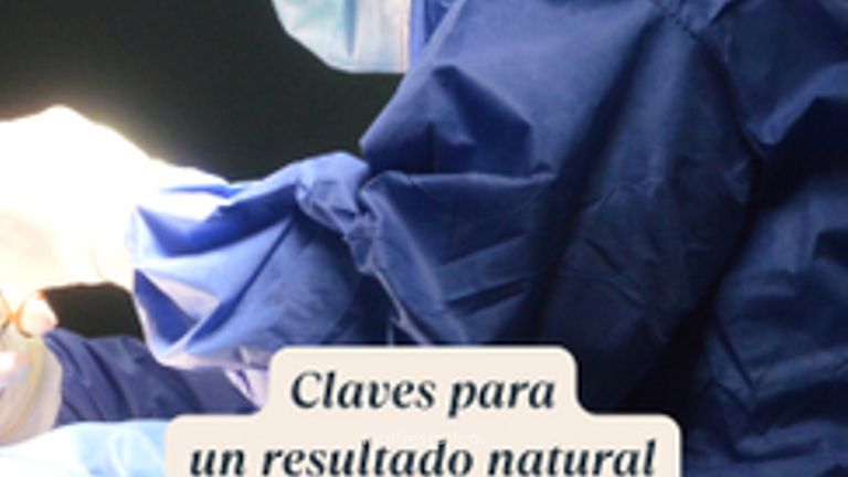 Claves para un resultado natural en un aumento mamario