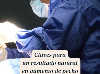 Claves para un resultado natural en un aumento mamario