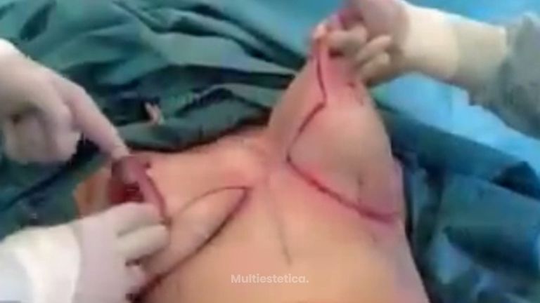 Luce el pecho que deseas