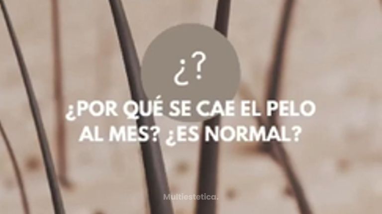 💬 ¿Por qué se me cae el pelo al mes de hacerme un injerto👉