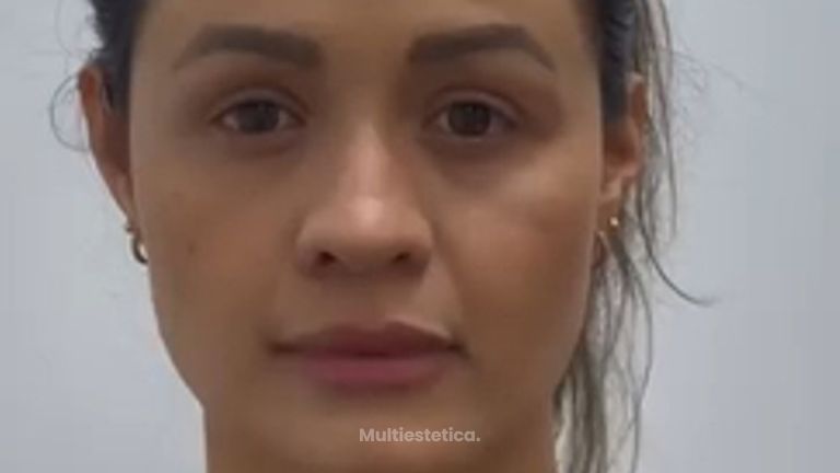 Hilos tensores