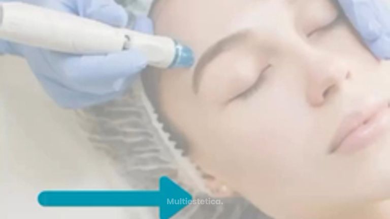 Limpieza HydraFacial - Grupo Médico Clínicas Massana