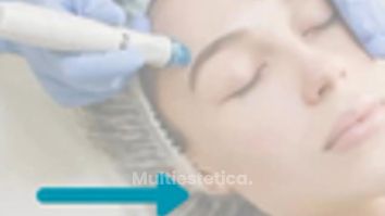 Limpieza HydraFacial - Grupo Médico Clínicas Massana