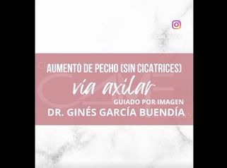 Clinicas Came Murcia - Aumento de Pecho